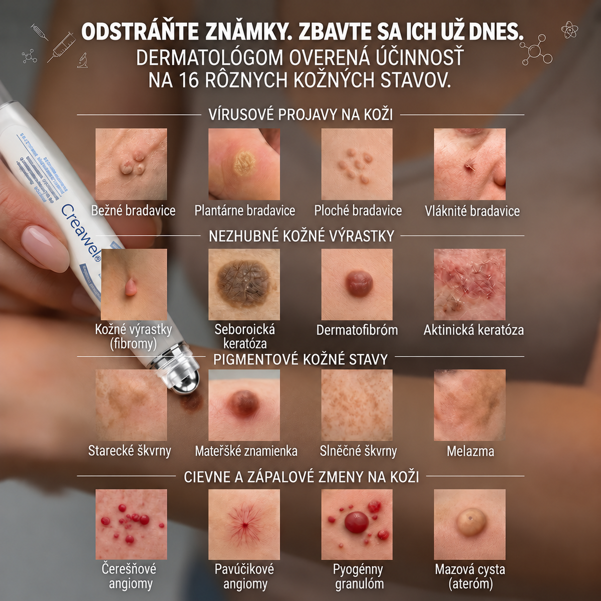 Hivatalos Márkabolt | ✌️ Creawel®  7 napos Szemölcseltávolító Roll-on Ápoló Folyadék (Fájdalommentes rollerball technológia, hegek nélkül)