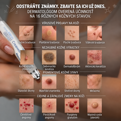 Hivatalos Márkabolt | ✌️ Creawel®  7 napos Szemölcseltávolító Roll-on Ápoló Folyadék (Fájdalommentes rollerball technológia, hegek nélkül)