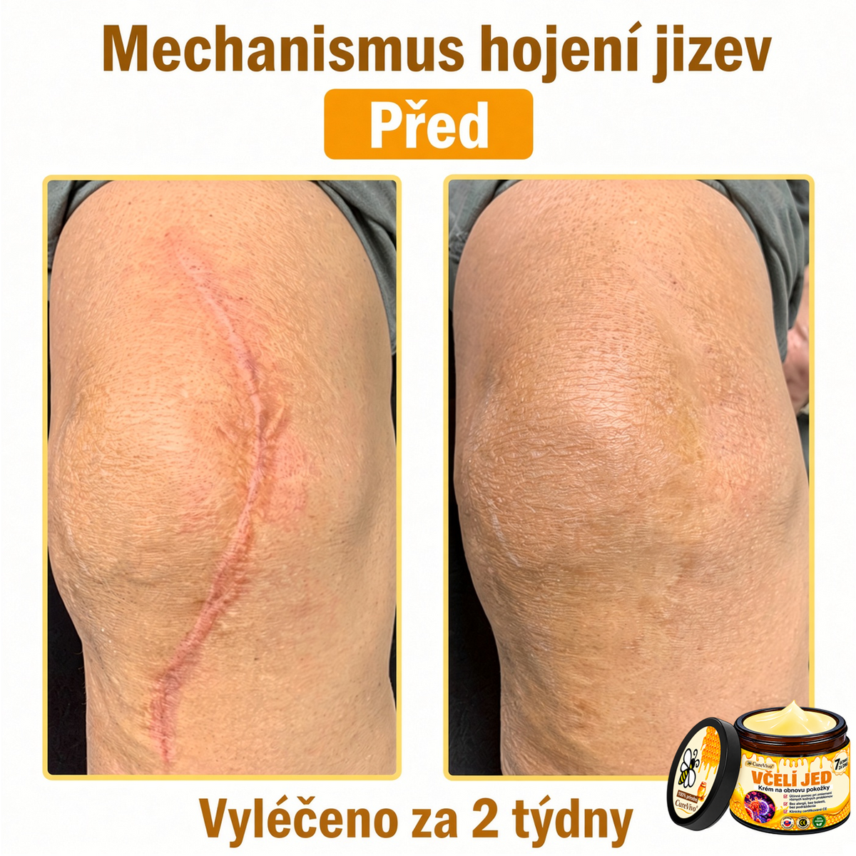 ⚡⚡𝐎𝐛𝐣𝐞𝐝𝐧𝐚𝐣𝐭𝐞 𝐬𝐢 𝐞š𝐭𝐞 𝐝𝐧𝐞𝐬 𝐚 𝐮š𝐞𝐭𝐫𝐢𝐭𝐞 𝟑𝟎%🐝 𝐂𝐮𝐫𝐞𝐕𝐢𝐯𝐨® 𝐨𝐛𝐧𝐨𝐯𝐮𝐣ú𝐜𝐢 𝐩𝐥𝐞ť𝐨𝐯ý 𝐤𝐫é𝐦 𝐬 𝐯č𝐞𝐥í𝐦 𝐣𝐞𝐝𝐨𝐦 🐝 𝐩𝐨𝐦á𝐡𝐚 𝐩𝐫𝐢 𝐬𝐭𝐚𝐫𝐨𝐬𝐭𝐥𝐢𝐯𝐨𝐬𝐭𝐢 𝐨 𝐫ô𝐳𝐧𝐞 𝐤𝐨ž𝐧é 𝐩𝐫𝐨𝐛𝐥é𝐦𝐲.