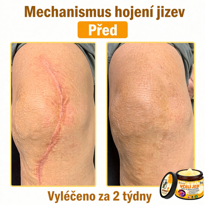 ⚡⚡𝐎𝐛𝐣𝐞𝐝𝐧𝐚𝐣𝐭𝐞 𝐬𝐢 𝐞š𝐭𝐞 𝐝𝐧𝐞𝐬 𝐚 𝐮š𝐞𝐭𝐫𝐢𝐭𝐞 𝟑𝟎%🐝 𝐂𝐮𝐫𝐞𝐕𝐢𝐯𝐨® 𝐨𝐛𝐧𝐨𝐯𝐮𝐣ú𝐜𝐢 𝐩𝐥𝐞ť𝐨𝐯ý 𝐤𝐫é𝐦 𝐬 𝐯č𝐞𝐥í𝐦 𝐣𝐞𝐝𝐨𝐦 🐝 𝐩𝐨𝐦á𝐡𝐚 𝐩𝐫𝐢 𝐬𝐭𝐚𝐫𝐨𝐬𝐭𝐥𝐢𝐯𝐨𝐬𝐭𝐢 𝐨 𝐫ô𝐳𝐧𝐞 𝐤𝐨ž𝐧é 𝐩𝐫𝐨𝐛𝐥é𝐦𝐲.