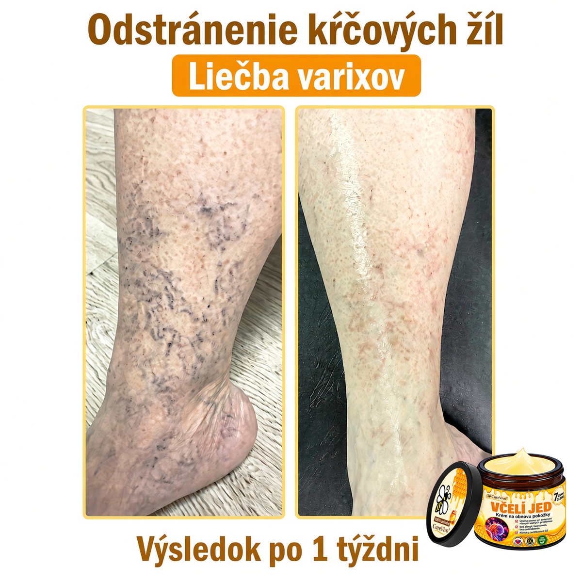 ⚡⚡𝐎𝐛𝐣𝐞𝐝𝐧𝐚𝐣𝐭𝐞 𝐬𝐢 𝐞š𝐭𝐞 𝐝𝐧𝐞𝐬 𝐚 𝐮š𝐞𝐭𝐫𝐢𝐭𝐞 𝟑𝟎%🐝 𝐂𝐮𝐫𝐞𝐕𝐢𝐯𝐨® 𝐨𝐛𝐧𝐨𝐯𝐮𝐣ú𝐜𝐢 𝐩𝐥𝐞ť𝐨𝐯ý 𝐤𝐫é𝐦 𝐬 𝐯č𝐞𝐥í𝐦 𝐣𝐞𝐝𝐨𝐦 🐝 𝐩𝐨𝐦á𝐡𝐚 𝐩𝐫𝐢 𝐬𝐭𝐚𝐫𝐨𝐬𝐭𝐥𝐢𝐯𝐨𝐬𝐭𝐢 𝐨 𝐫ô𝐳𝐧𝐞 𝐤𝐨ž𝐧é 𝐩𝐫𝐨𝐛𝐥é𝐦𝐲.