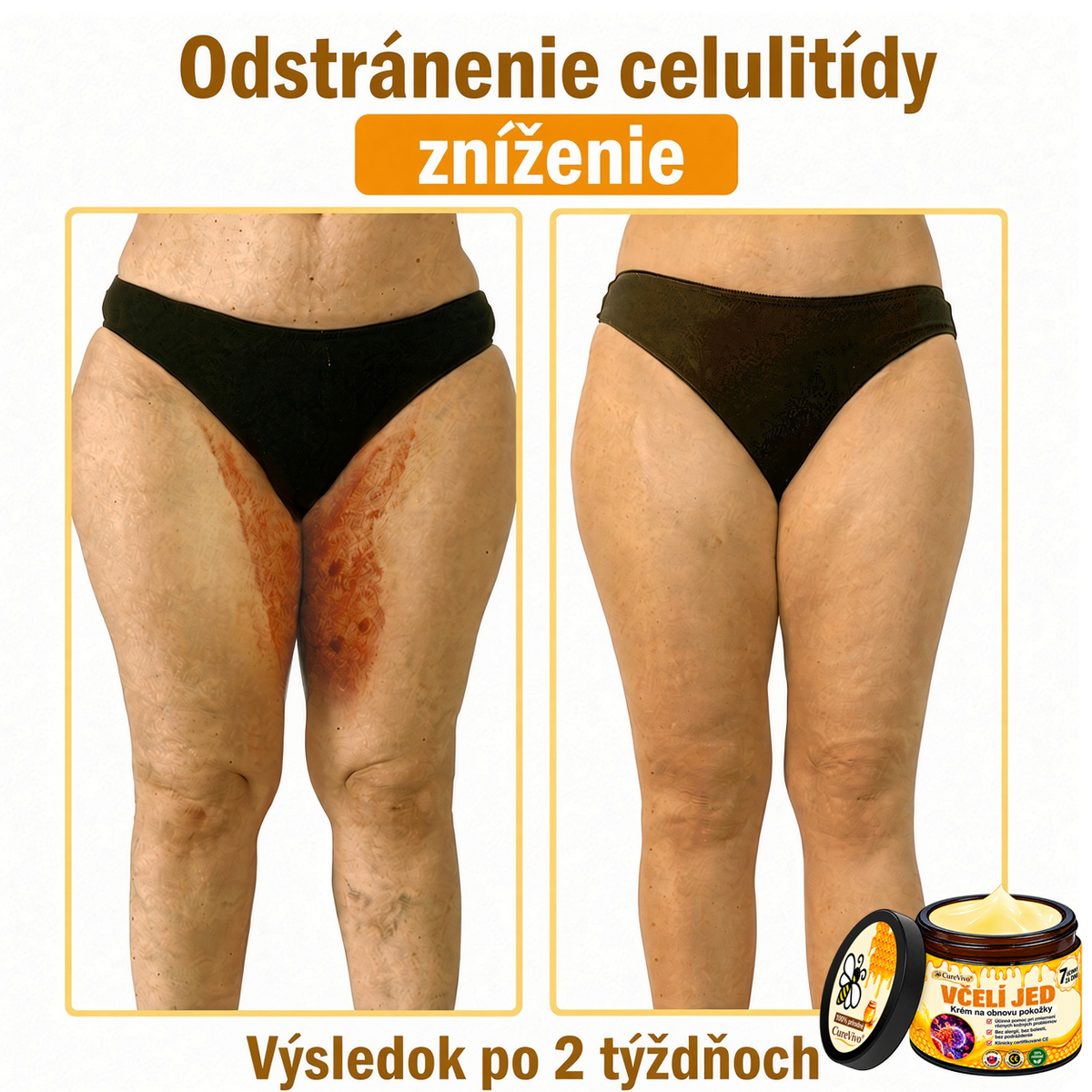 ⚡⚡𝐎𝐛𝐣𝐞𝐝𝐧𝐚𝐣𝐭𝐞 𝐬𝐢 𝐞š𝐭𝐞 𝐝𝐧𝐞𝐬 𝐚 𝐮š𝐞𝐭𝐫𝐢𝐭𝐞 𝟑𝟎%🐝 𝐂𝐮𝐫𝐞𝐕𝐢𝐯𝐨® 𝐨𝐛𝐧𝐨𝐯𝐮𝐣ú𝐜𝐢 𝐩𝐥𝐞ť𝐨𝐯ý 𝐤𝐫é𝐦 𝐬 𝐯č𝐞𝐥í𝐦 𝐣𝐞𝐝𝐨𝐦 🐝 𝐩𝐨𝐦á𝐡𝐚 𝐩𝐫𝐢 𝐬𝐭𝐚𝐫𝐨𝐬𝐭𝐥𝐢𝐯𝐨𝐬𝐭𝐢 𝐨 𝐫ô𝐳𝐧𝐞 𝐤𝐨ž𝐧é 𝐩𝐫𝐨𝐛𝐥é𝐦𝐲.