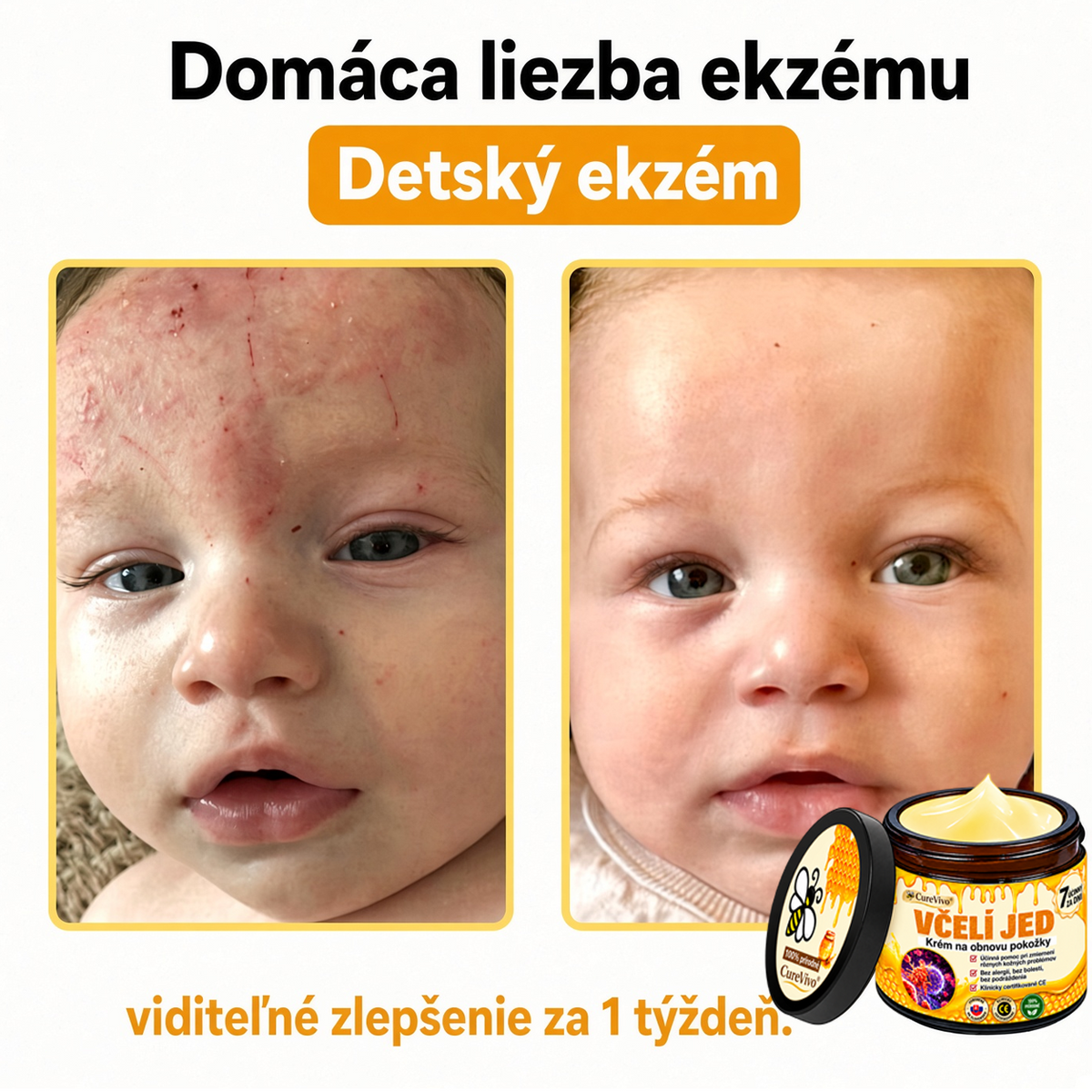 ⚡⚡𝐎𝐛𝐣𝐞𝐝𝐧𝐚𝐣𝐭𝐞 𝐬𝐢 𝐞š𝐭𝐞 𝐝𝐧𝐞𝐬 𝐚 𝐮š𝐞𝐭𝐫𝐢𝐭𝐞 𝟑𝟎%🐝 𝐂𝐮𝐫𝐞𝐕𝐢𝐯𝐨® 𝐨𝐛𝐧𝐨𝐯𝐮𝐣ú𝐜𝐢 𝐩𝐥𝐞ť𝐨𝐯ý 𝐤𝐫é𝐦 𝐬 𝐯č𝐞𝐥í𝐦 𝐣𝐞𝐝𝐨𝐦 🐝 𝐩𝐨𝐦á𝐡𝐚 𝐩𝐫𝐢 𝐬𝐭𝐚𝐫𝐨𝐬𝐭𝐥𝐢𝐯𝐨𝐬𝐭𝐢 𝐨 𝐫ô𝐳𝐧𝐞 𝐤𝐨ž𝐧é 𝐩𝐫𝐨𝐛𝐥é𝐦𝐲.