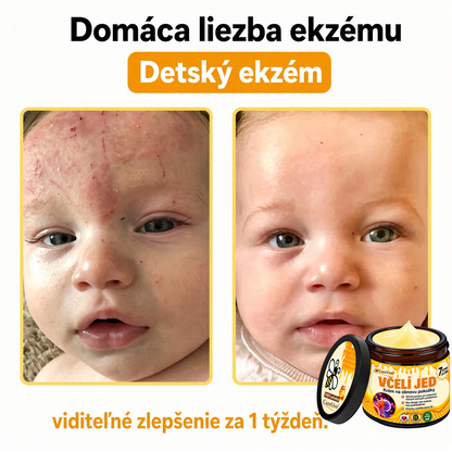 ⚡⚡𝐎𝐛𝐣𝐞𝐝𝐧𝐚𝐣𝐭𝐞 𝐬𝐢 𝐞š𝐭𝐞 𝐝𝐧𝐞𝐬 𝐚 𝐮š𝐞𝐭𝐫𝐢𝐭𝐞 𝟑𝟎%🐝 𝐂𝐮𝐫𝐞𝐕𝐢𝐯𝐨® 𝐨𝐛𝐧𝐨𝐯𝐮𝐣ú𝐜𝐢 𝐩𝐥𝐞ť𝐨𝐯ý 𝐤𝐫é𝐦 𝐬 𝐯č𝐞𝐥í𝐦 𝐣𝐞𝐝𝐨𝐦 🐝 𝐩𝐨𝐦á𝐡𝐚 𝐩𝐫𝐢 𝐬𝐭𝐚𝐫𝐨𝐬𝐭𝐥𝐢𝐯𝐨𝐬𝐭𝐢 𝐨 𝐫ô𝐳𝐧𝐞 𝐤𝐨ž𝐧é 𝐩𝐫𝐨𝐛𝐥é𝐦𝐲.