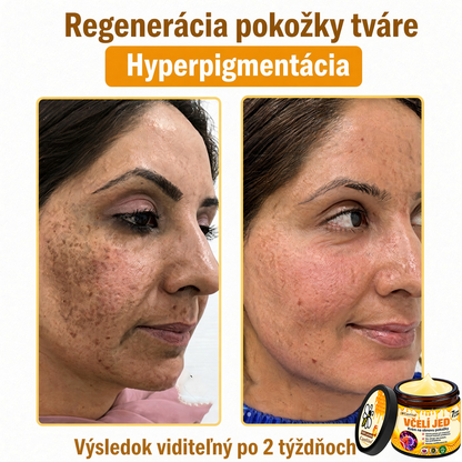 ⚡⚡𝐎𝐛𝐣𝐞𝐝𝐧𝐚𝐣𝐭𝐞 𝐬𝐢 𝐞š𝐭𝐞 𝐝𝐧𝐞𝐬 𝐚 𝐮š𝐞𝐭𝐫𝐢𝐭𝐞 𝟑𝟎%🐝 𝐂𝐮𝐫𝐞𝐕𝐢𝐯𝐨® 𝐨𝐛𝐧𝐨𝐯𝐮𝐣ú𝐜𝐢 𝐩𝐥𝐞ť𝐨𝐯ý 𝐤𝐫é𝐦 𝐬 𝐯č𝐞𝐥í𝐦 𝐣𝐞𝐝𝐨𝐦 🐝 𝐩𝐨𝐦á𝐡𝐚 𝐩𝐫𝐢 𝐬𝐭𝐚𝐫𝐨𝐬𝐭𝐥𝐢𝐯𝐨𝐬𝐭𝐢 𝐨 𝐫ô𝐳𝐧𝐞 𝐤𝐨ž𝐧é 𝐩𝐫𝐨𝐛𝐥é𝐦𝐲.