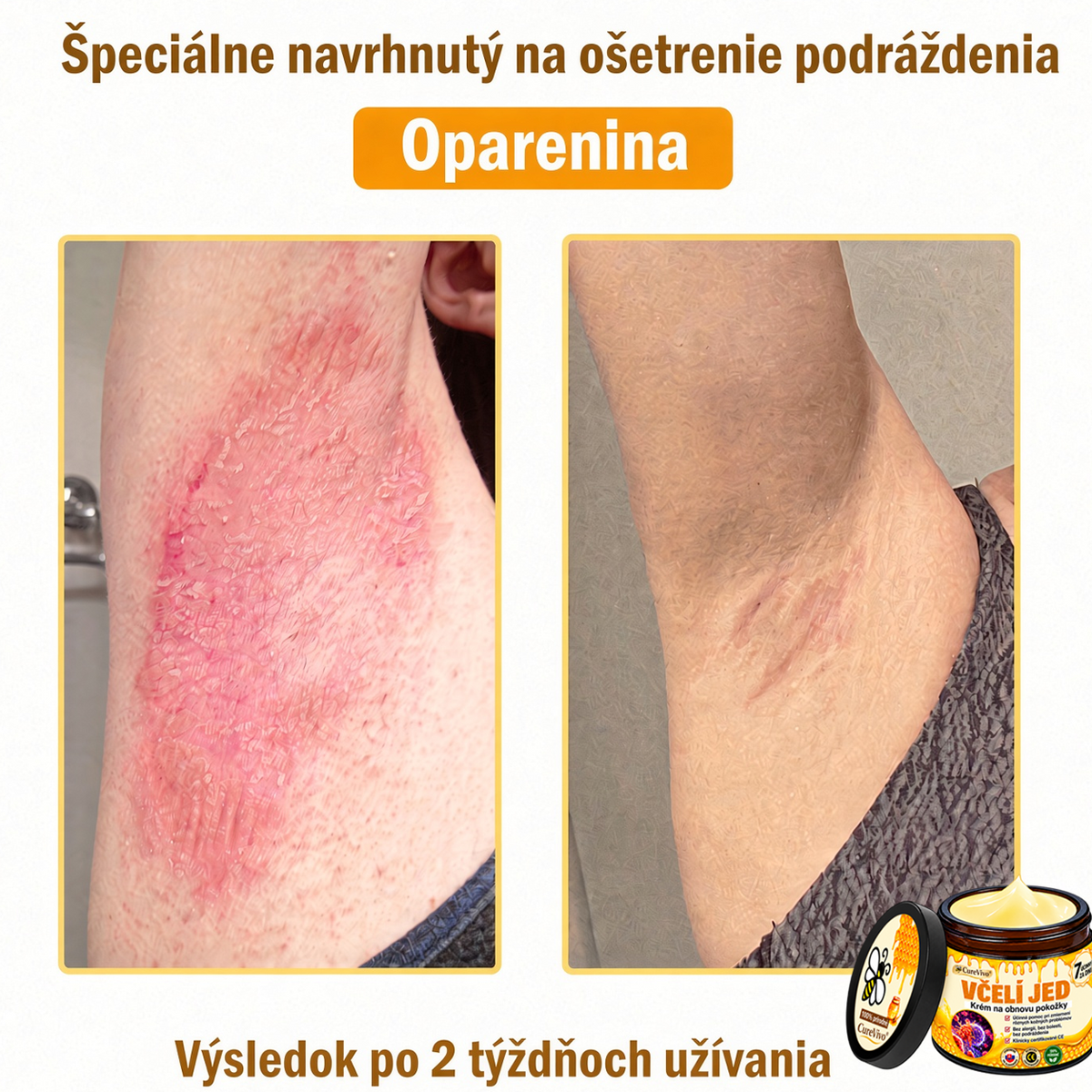 ⚡⚡𝐎𝐛𝐣𝐞𝐝𝐧𝐚𝐣𝐭𝐞 𝐬𝐢 𝐞š𝐭𝐞 𝐝𝐧𝐞𝐬 𝐚 𝐮š𝐞𝐭𝐫𝐢𝐭𝐞 𝟑𝟎%🐝 𝐂𝐮𝐫𝐞𝐕𝐢𝐯𝐨® 𝐨𝐛𝐧𝐨𝐯𝐮𝐣ú𝐜𝐢 𝐩𝐥𝐞ť𝐨𝐯ý 𝐤𝐫é𝐦 𝐬 𝐯č𝐞𝐥í𝐦 𝐣𝐞𝐝𝐨𝐦 🐝 𝐩𝐨𝐦á𝐡𝐚 𝐩𝐫𝐢 𝐬𝐭𝐚𝐫𝐨𝐬𝐭𝐥𝐢𝐯𝐨𝐬𝐭𝐢 𝐨 𝐫ô𝐳𝐧𝐞 𝐤𝐨ž𝐧é 𝐩𝐫𝐨𝐛𝐥é𝐦𝐲.