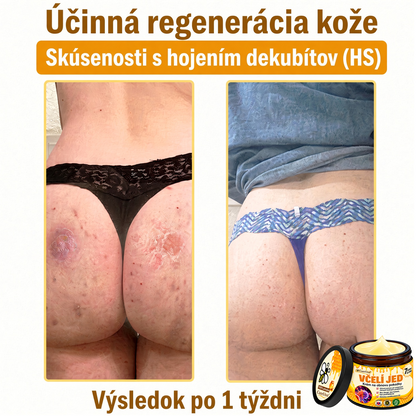 ⚡⚡𝐎𝐛𝐣𝐞𝐝𝐧𝐚𝐣𝐭𝐞 𝐬𝐢 𝐞š𝐭𝐞 𝐝𝐧𝐞𝐬 𝐚 𝐮š𝐞𝐭𝐫𝐢𝐭𝐞 𝟑𝟎%🐝 𝐂𝐮𝐫𝐞𝐕𝐢𝐯𝐨® 𝐨𝐛𝐧𝐨𝐯𝐮𝐣ú𝐜𝐢 𝐩𝐥𝐞ť𝐨𝐯ý 𝐤𝐫é𝐦 𝐬 𝐯č𝐞𝐥í𝐦 𝐣𝐞𝐝𝐨𝐦 🐝 𝐩𝐨𝐦á𝐡𝐚 𝐩𝐫𝐢 𝐬𝐭𝐚𝐫𝐨𝐬𝐭𝐥𝐢𝐯𝐨𝐬𝐭𝐢 𝐨 𝐫ô𝐳𝐧𝐞 𝐤𝐨ž𝐧é 𝐩𝐫𝐨𝐛𝐥é𝐦𝐲.