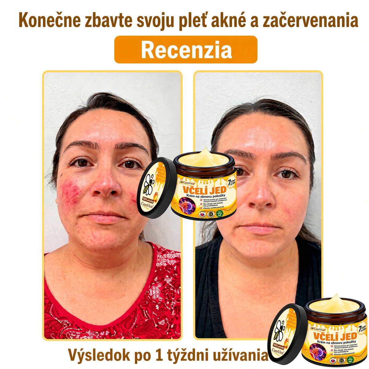 ⚡⚡𝐎𝐛𝐣𝐞𝐝𝐧𝐚𝐣𝐭𝐞 𝐬𝐢 𝐞š𝐭𝐞 𝐝𝐧𝐞𝐬 𝐚 𝐮š𝐞𝐭𝐫𝐢𝐭𝐞 𝟑𝟎%🐝 𝐂𝐮𝐫𝐞𝐕𝐢𝐯𝐨® 𝐨𝐛𝐧𝐨𝐯𝐮𝐣ú𝐜𝐢 𝐩𝐥𝐞ť𝐨𝐯ý 𝐤𝐫é𝐦 𝐬 𝐯č𝐞𝐥í𝐦 𝐣𝐞𝐝𝐨𝐦 🐝 𝐩𝐨𝐦á𝐡𝐚 𝐩𝐫𝐢 𝐬𝐭𝐚𝐫𝐨𝐬𝐭𝐥𝐢𝐯𝐨𝐬𝐭𝐢 𝐨 𝐫ô𝐳𝐧𝐞 𝐤𝐨ž𝐧é 𝐩𝐫𝐨𝐛𝐥é𝐦𝐲.