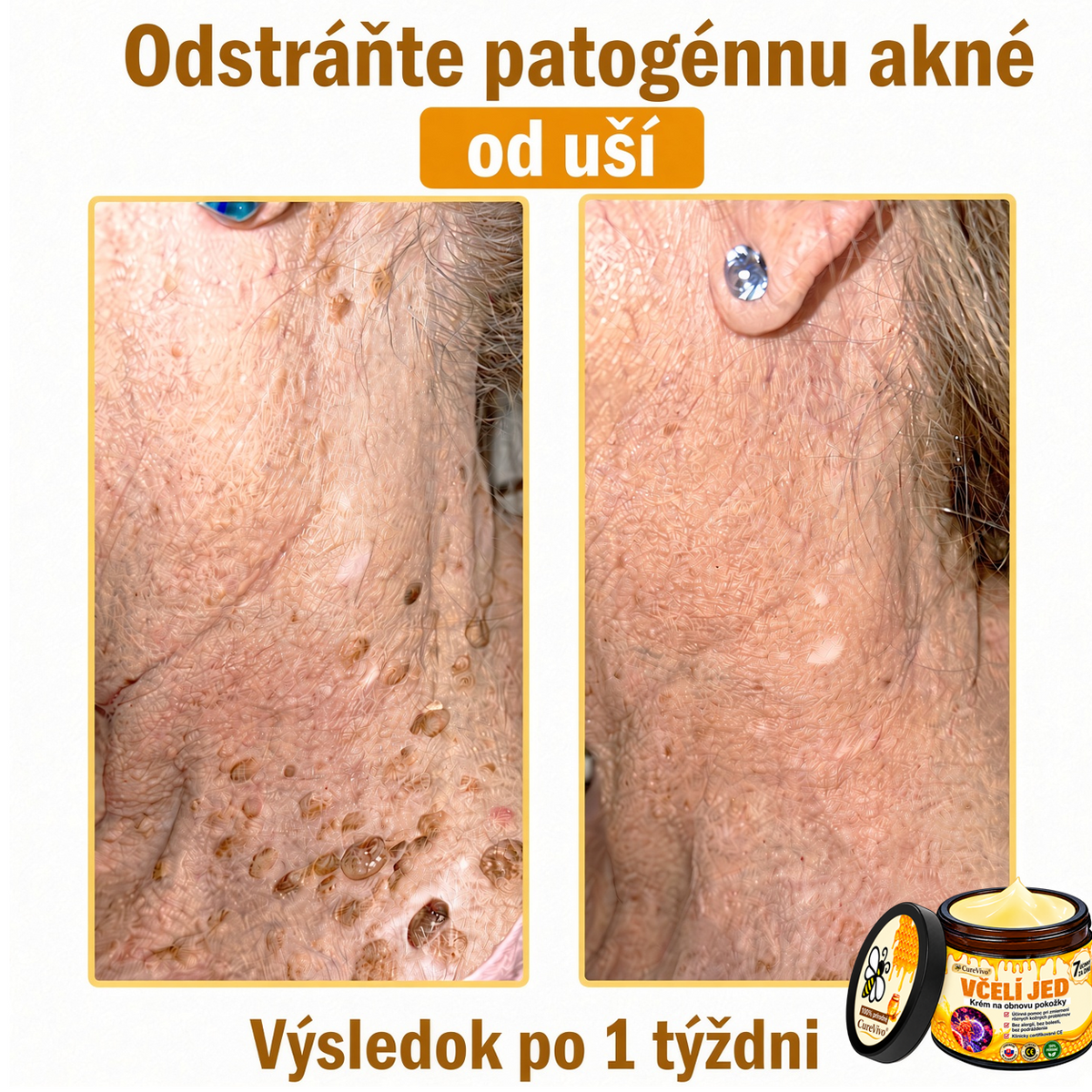 ⚡⚡𝐎𝐛𝐣𝐞𝐝𝐧𝐚𝐣𝐭𝐞 𝐬𝐢 𝐞š𝐭𝐞 𝐝𝐧𝐞𝐬 𝐚 𝐮š𝐞𝐭𝐫𝐢𝐭𝐞 𝟑𝟎%🐝 𝐂𝐮𝐫𝐞𝐕𝐢𝐯𝐨® 𝐨𝐛𝐧𝐨𝐯𝐮𝐣ú𝐜𝐢 𝐩𝐥𝐞ť𝐨𝐯ý 𝐤𝐫é𝐦 𝐬 𝐯č𝐞𝐥í𝐦 𝐣𝐞𝐝𝐨𝐦 🐝 𝐩𝐨𝐦á𝐡𝐚 𝐩𝐫𝐢 𝐬𝐭𝐚𝐫𝐨𝐬𝐭𝐥𝐢𝐯𝐨𝐬𝐭𝐢 𝐨 𝐫ô𝐳𝐧𝐞 𝐤𝐨ž𝐧é 𝐩𝐫𝐨𝐛𝐥é𝐦𝐲.