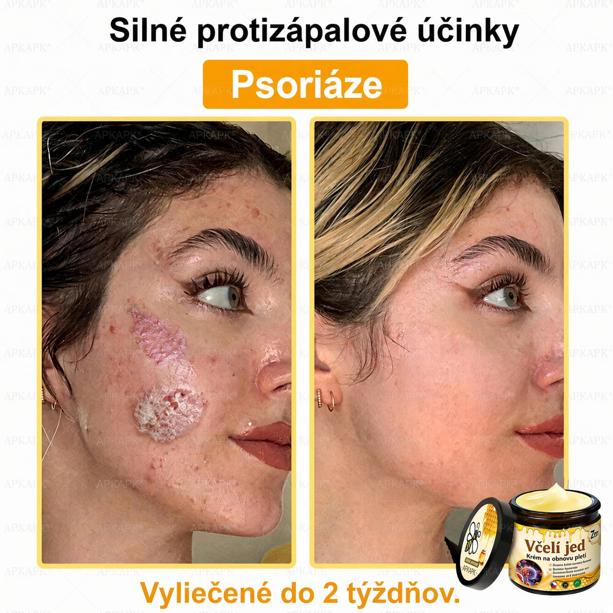 ⚡⚡𝐎𝐛𝐣𝐞𝐝𝐧𝐚𝐣𝐭𝐞 𝐬𝐢 𝐞š𝐭𝐞 𝐝𝐧𝐞𝐬 𝐚 𝐮š𝐞𝐭𝐫𝐢𝐭𝐞 𝟑𝟎%🐝 𝐂𝐮𝐫𝐞𝐕𝐢𝐯𝐨® 𝐨𝐛𝐧𝐨𝐯𝐮𝐣ú𝐜𝐢 𝐩𝐥𝐞ť𝐨𝐯ý 𝐤𝐫é𝐦 𝐬 𝐯č𝐞𝐥í𝐦 𝐣𝐞𝐝𝐨𝐦 🐝 𝐩𝐨𝐦á𝐡𝐚 𝐩𝐫𝐢 𝐬𝐭𝐚𝐫𝐨𝐬𝐭𝐥𝐢𝐯𝐨𝐬𝐭𝐢 𝐨 𝐫ô𝐳𝐧𝐞 𝐤𝐨ž𝐧é 𝐩𝐫𝐨𝐛𝐥é𝐦𝐲.