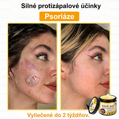 ⚡⚡𝐎𝐛𝐣𝐞𝐝𝐧𝐚𝐣𝐭𝐞 𝐬𝐢 𝐞š𝐭𝐞 𝐝𝐧𝐞𝐬 𝐚 𝐮š𝐞𝐭𝐫𝐢𝐭𝐞 𝟑𝟎%🐝 𝐂𝐮𝐫𝐞𝐕𝐢𝐯𝐨® 𝐨𝐛𝐧𝐨𝐯𝐮𝐣ú𝐜𝐢 𝐩𝐥𝐞ť𝐨𝐯ý 𝐤𝐫é𝐦 𝐬 𝐯č𝐞𝐥í𝐦 𝐣𝐞𝐝𝐨𝐦 🐝 𝐩𝐨𝐦á𝐡𝐚 𝐩𝐫𝐢 𝐬𝐭𝐚𝐫𝐨𝐬𝐭𝐥𝐢𝐯𝐨𝐬𝐭𝐢 𝐨 𝐫ô𝐳𝐧𝐞 𝐤𝐨ž𝐧é 𝐩𝐫𝐨𝐛𝐥é𝐦𝐲.
