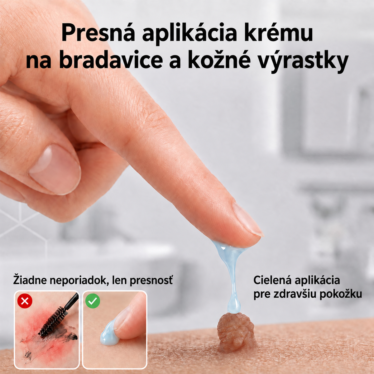♟️ CureVivo® 7-dňový krém na kožné výrastky a škvrny (bezbolestné zloženie – bez jaziev)🤗